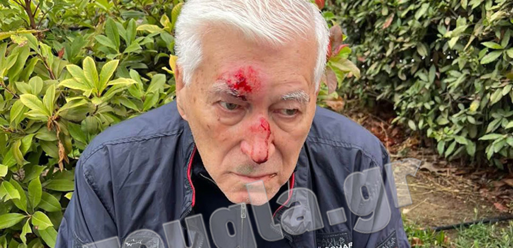 Θεσσαλονίκη: Γνωστός γιατρός φέρεται να ξυλοκόπησε άγρια ηλικιωμένο μετά από ασήμαντο τροχαίο - Σοκάρουν οι φωτογραφίες