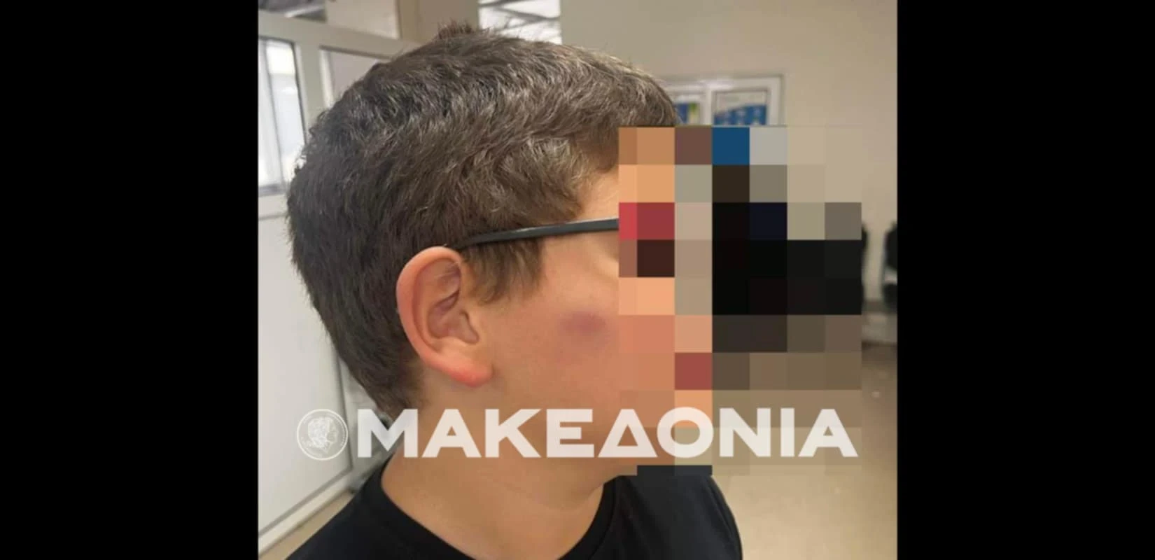 Θεσσαλονίκη: ΕΔΕ για τον ξυλοδαρμό μαθητή από άλλους μαθητές σε δημοτικό σχολείο στο Παλαιόκαστρο