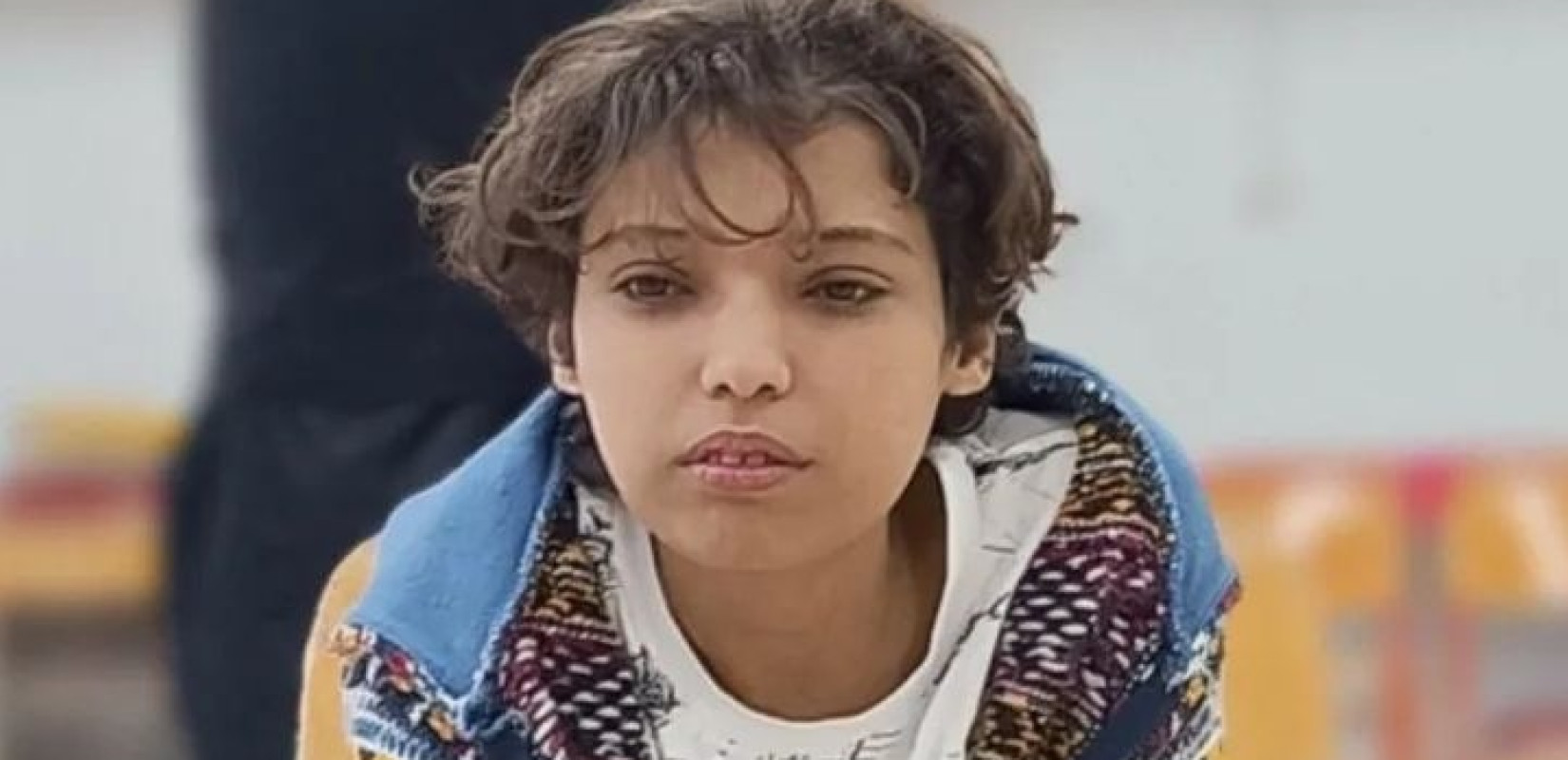 Τορίνο: Με επιτυχία πραγματοποιήθηκε η μεταμόσχευση ήπατος στον 18χρονο Μάριο