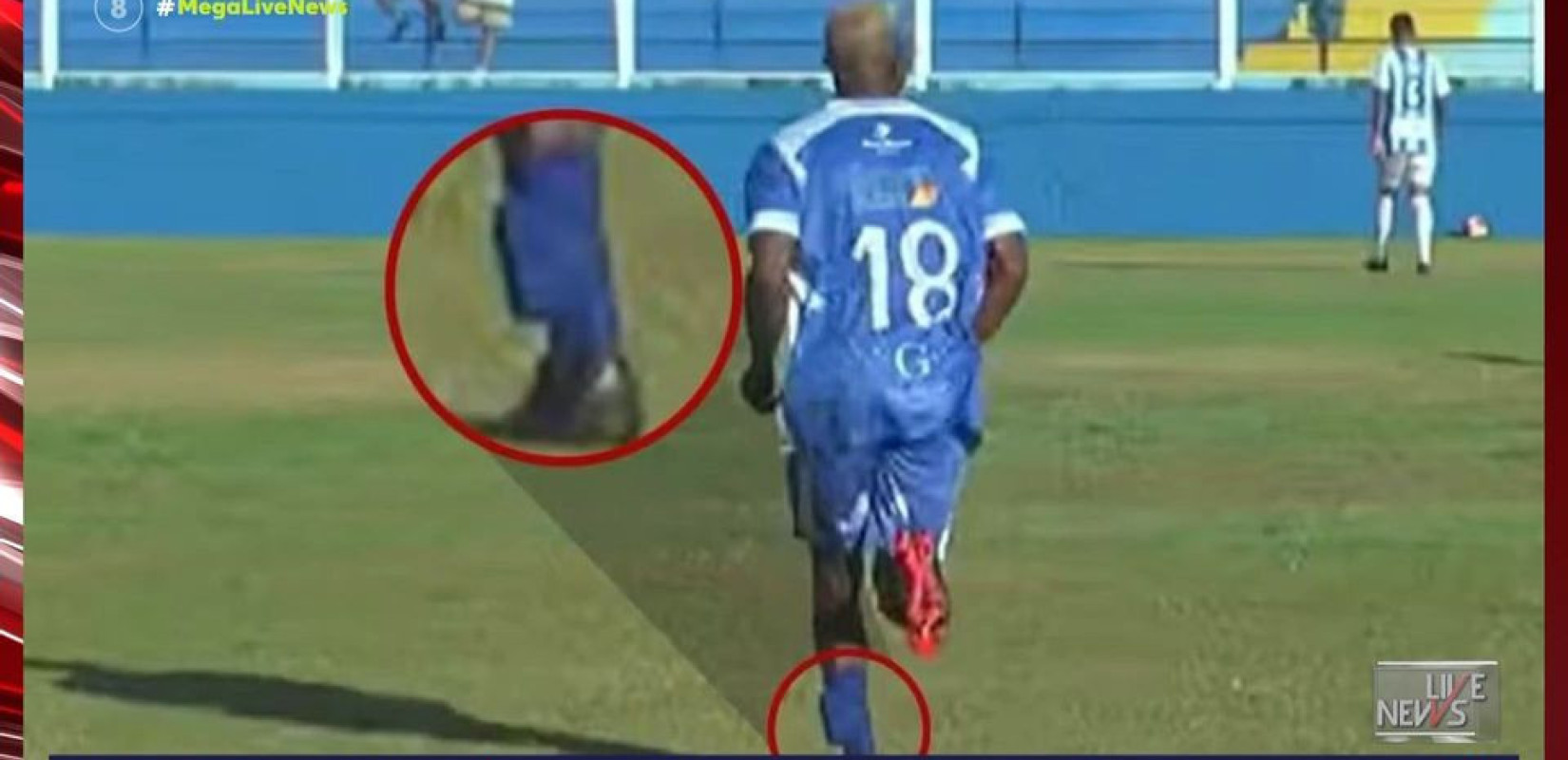 Σάλος στη Βραζιλία: Ποδοσφαιριστής αγωνίζεται φορώντας «βραχιολάκι» στο πόδι (βίντεο)