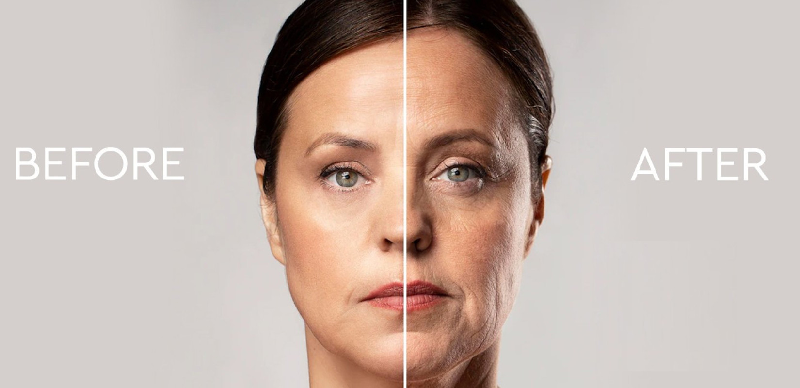 Ozempic Face: Όταν η γρήγορη απώλεια βάρους «αδειάζει» το πρόσωπο