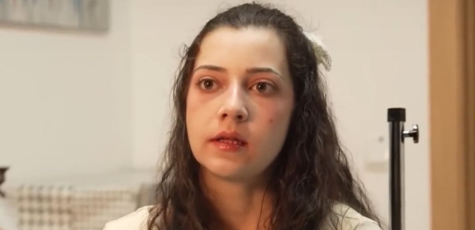 Ισπανία: 25χρονη τετραπληγική υποβλήθηκε σε ευθανασία, παρά τις αντιρρήσεις της οικογένειάς της (βίντεο)