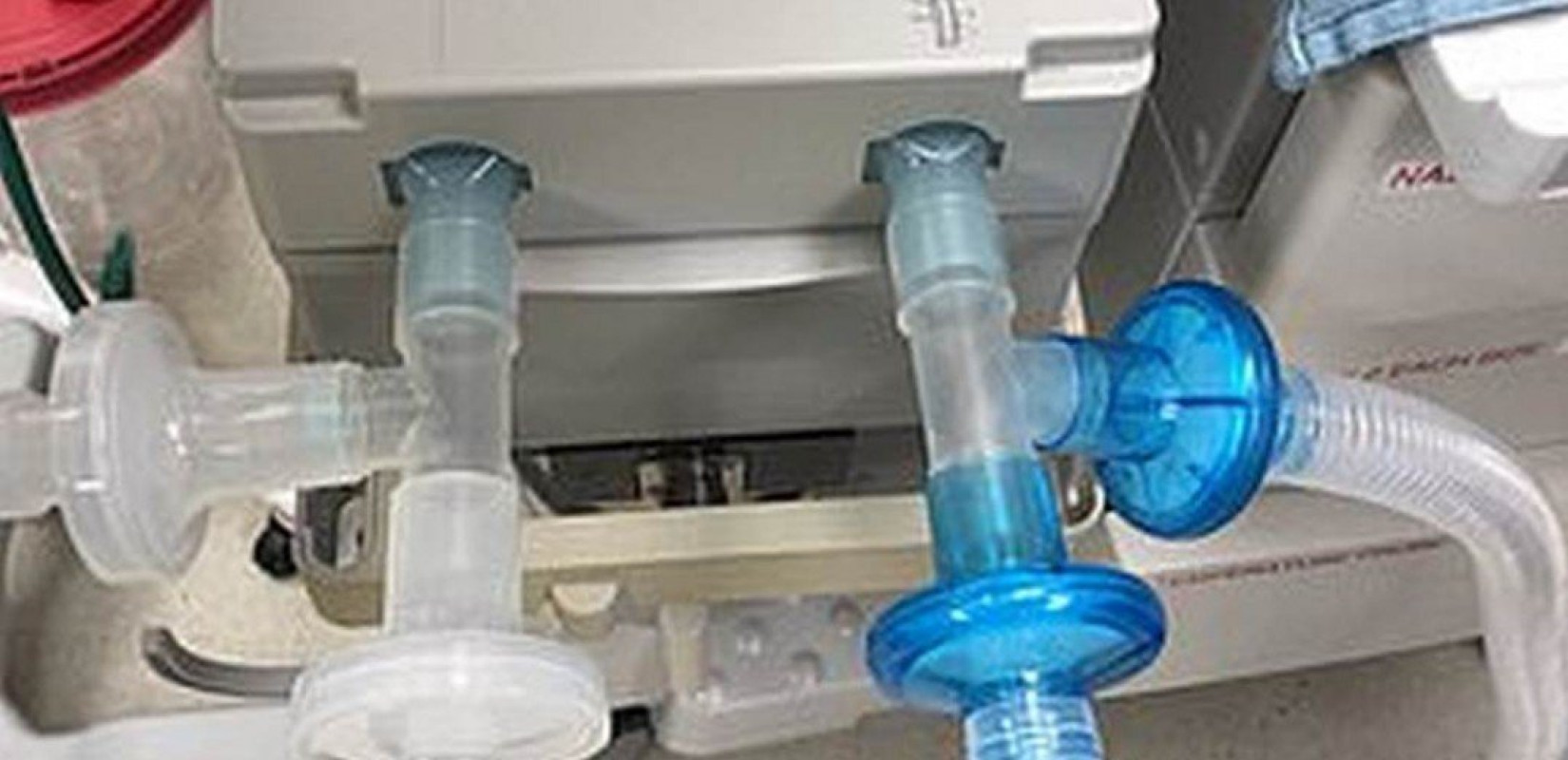 Η Ιερά Μητρόπολη Θεσσαλονίκης ενισχύει τρία νοσοκομεία της πόλης με αναπνευστήρες υψηλής ροής 