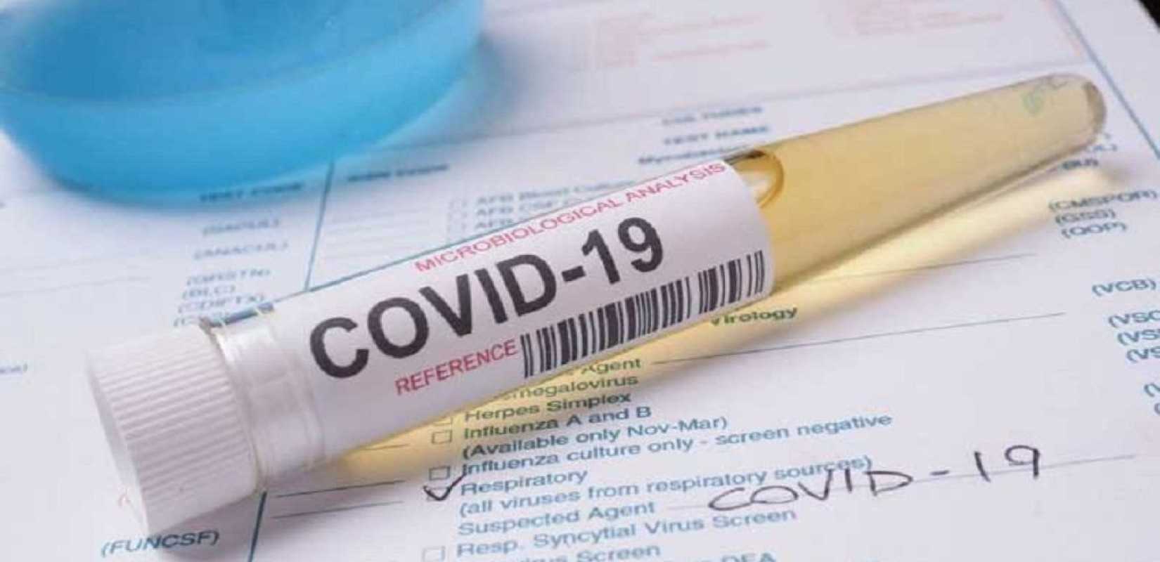 Όσοι τουρίστες επιστρέφουν στο Βέλγιο από την Ελλάδα, θα υποβάλλονται σε τεστ για κορονοϊό