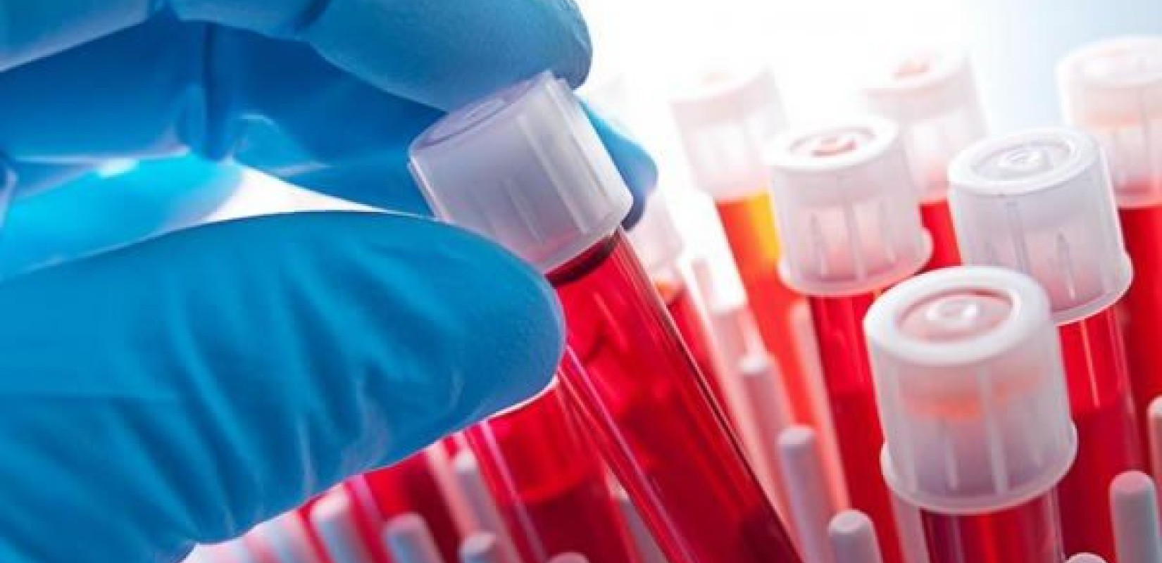 Θεσσαλονίκη: Με ακρίβεια γίνεται η διάγνωση σπάνιων αιματολογικών νοσημάτων στο νοσοκομείο Παπανικολάου