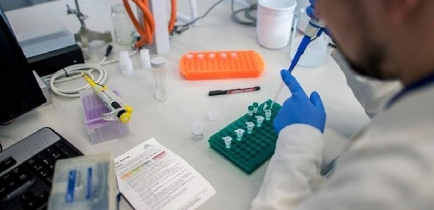  Ηλ. Μόσιαλος: Γιατί πρέπει να ελεγχθεί η διασπορά της πιο μεταδοτικής παραλλαγής Δέλτα του κορονοϊού