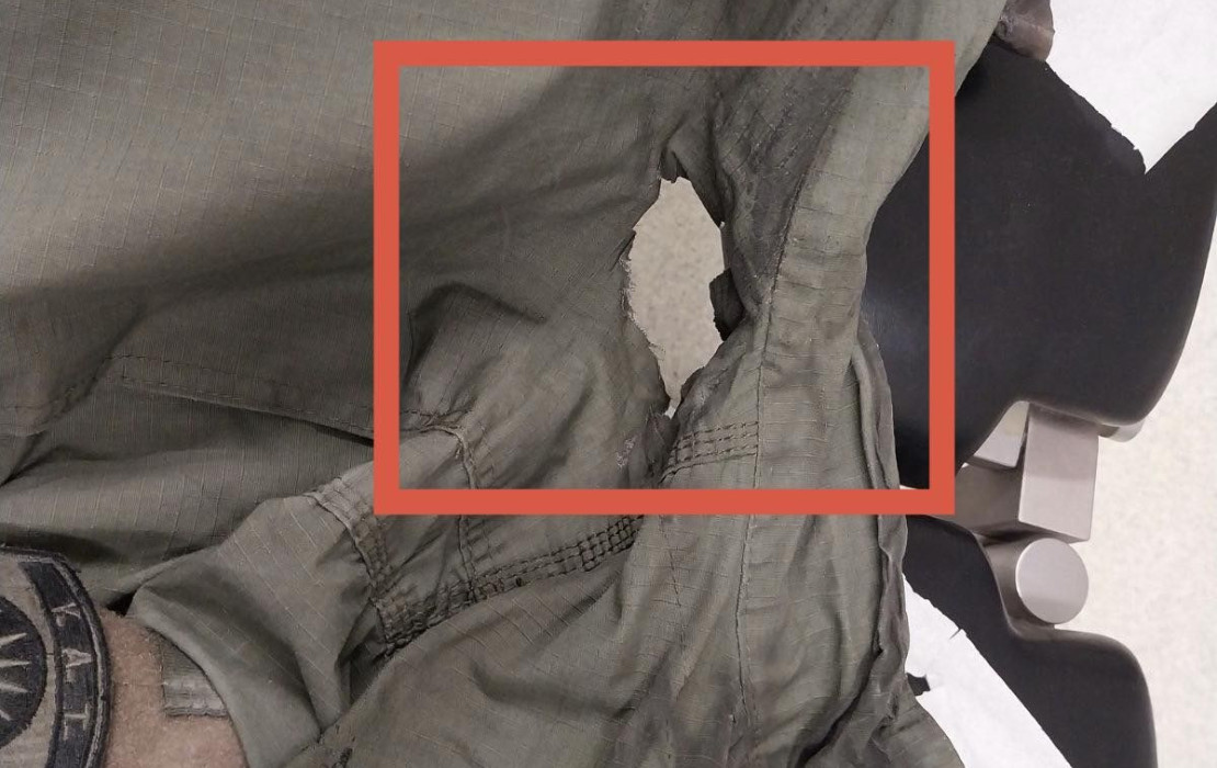 Σύγχρονα μέσα ζητούν οι αστυνομικοί της Θεσσαλονίκης - Η μολότοφ άνοιξε τρύπα στη στολή του αστυνομικού στα επεισόδια του ΑΠΘ